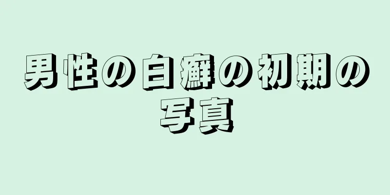 男性の白癬の初期の写真