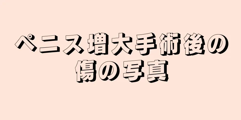 ペニス増大手術後の傷の写真