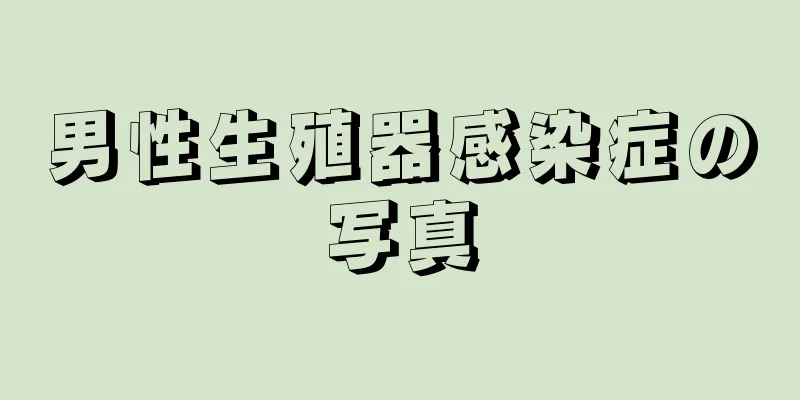 男性生殖器感染症の写真