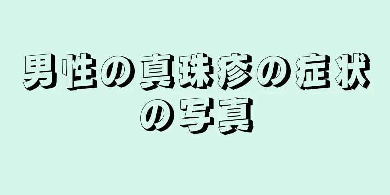 男性の真珠疹の症状の写真
