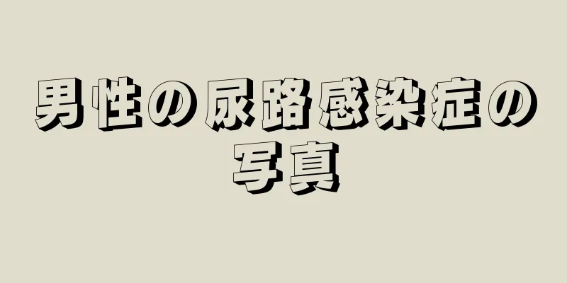 男性の尿路感染症の写真