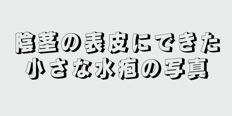 陰茎の表皮にできた小さな水疱の写真