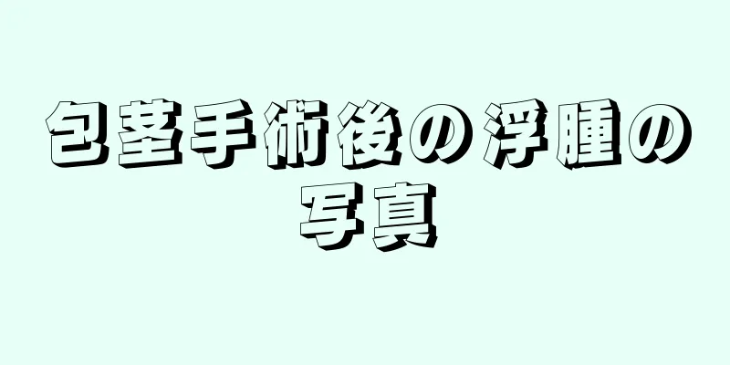 包茎手術後の浮腫の写真