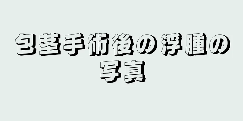 包茎手術後の浮腫の写真