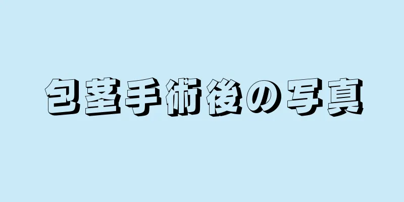 包茎手術後の写真