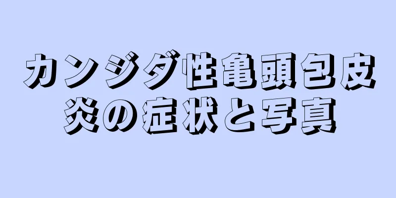 カンジダ性亀頭包皮炎の症状と写真