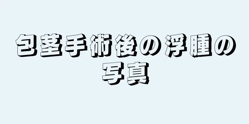包茎手術後の浮腫の写真