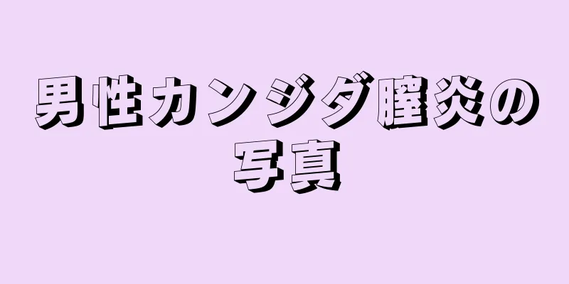 男性カンジダ膣炎の写真
