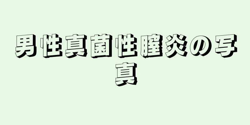 男性真菌性膣炎の写真