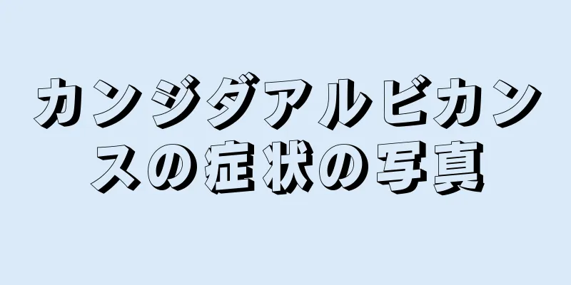 カンジダアルビカンスの症状の写真