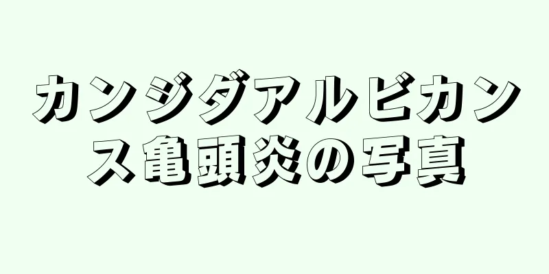 カンジダアルビカンス亀頭炎の写真