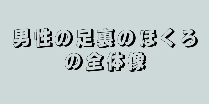 男性の足裏のほくろの全体像