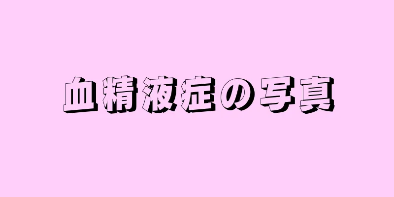 血精液症の写真