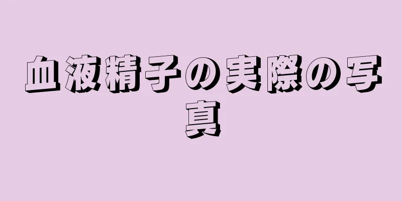 血液精子の実際の写真