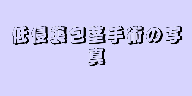 低侵襲包茎手術の写真