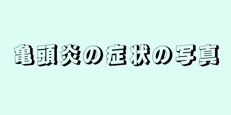 亀頭炎の症状の写真