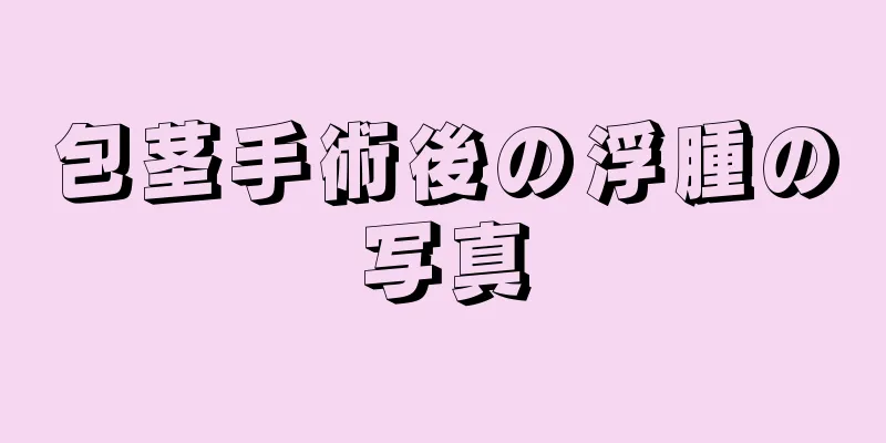包茎手術後の浮腫の写真