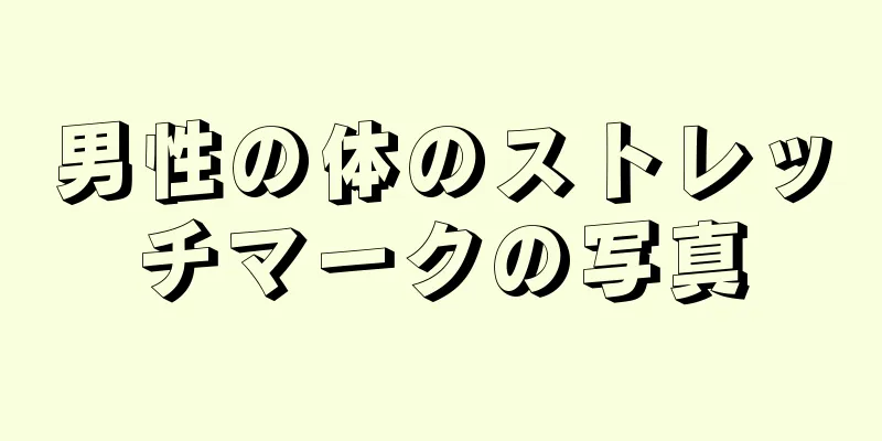 男性の体のストレッチマークの写真