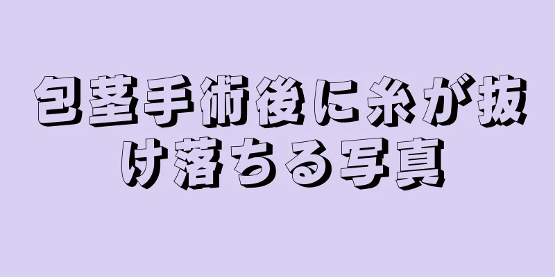 包茎手術後に糸が抜け落ちる写真