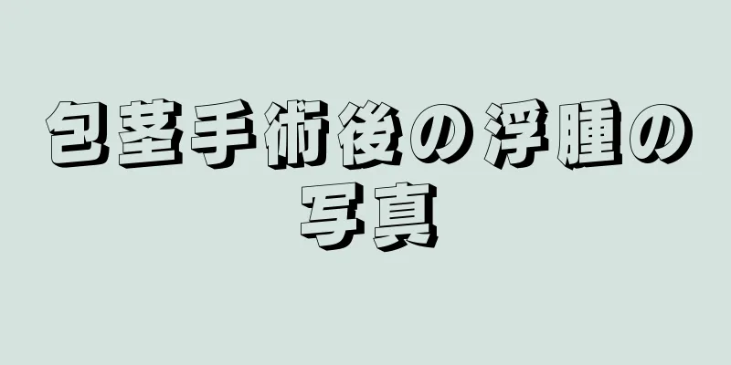 包茎手術後の浮腫の写真