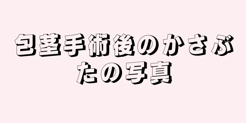 包茎手術後のかさぶたの写真