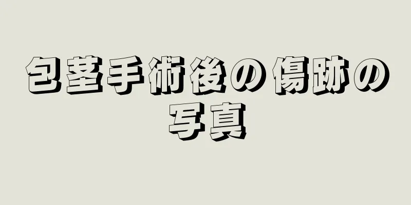 包茎手術後の傷跡の写真