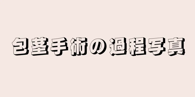 包茎手術の過程写真