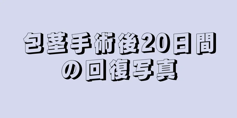 包茎手術後20日間の回復写真