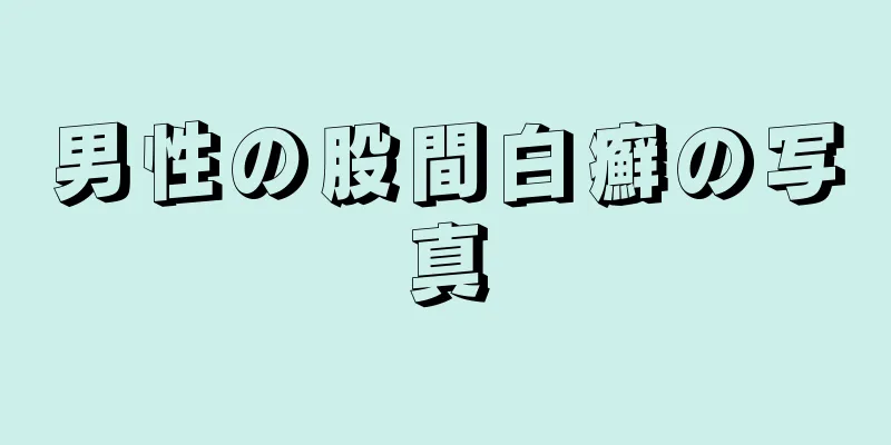 男性の股間白癬の写真