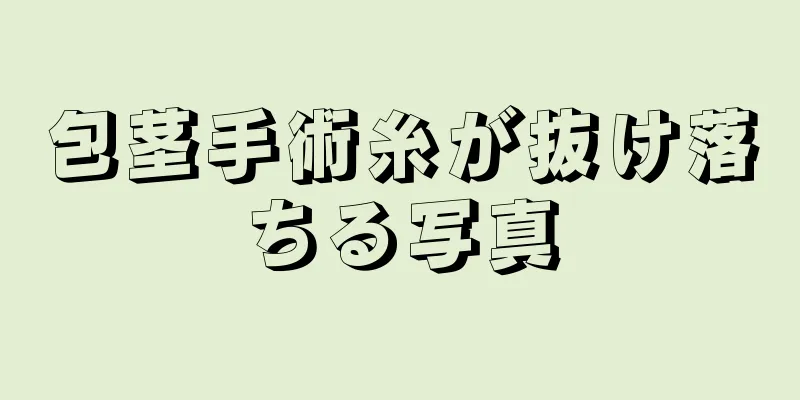 包茎手術糸が抜け落ちる写真