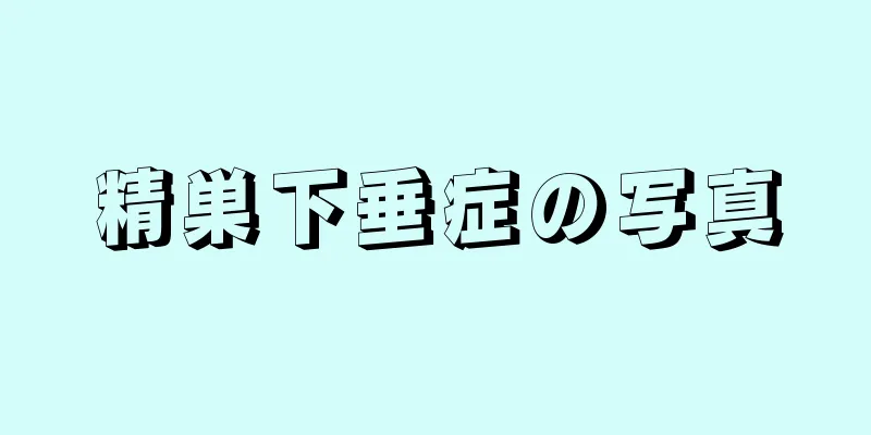 精巣下垂症の写真
