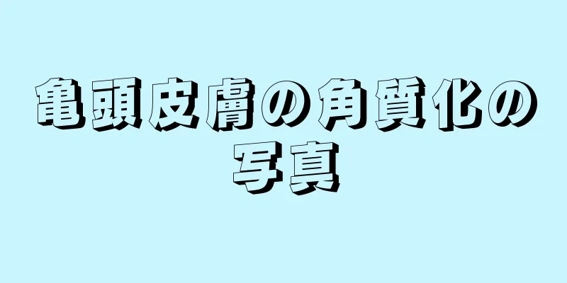 亀頭皮膚の角質化の写真
