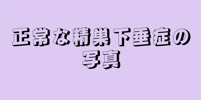 正常な精巣下垂症の写真