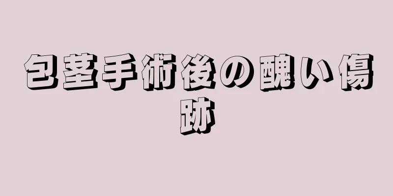 包茎手術後の醜い傷跡