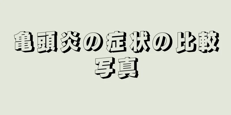 亀頭炎の症状の比較写真