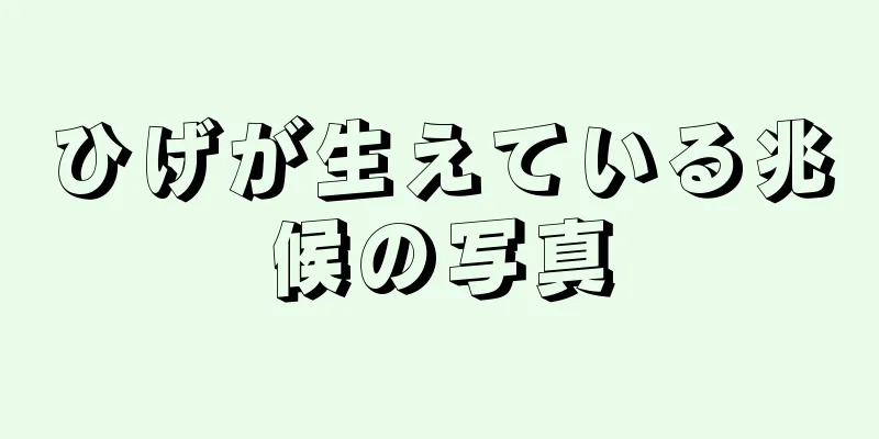 ひげが生えている兆候の写真