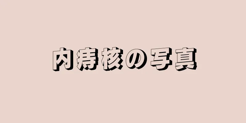 内痔核の写真