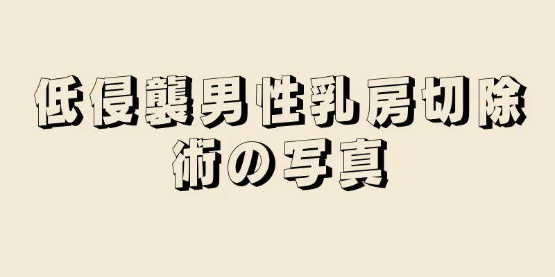 低侵襲男性乳房切除術の写真