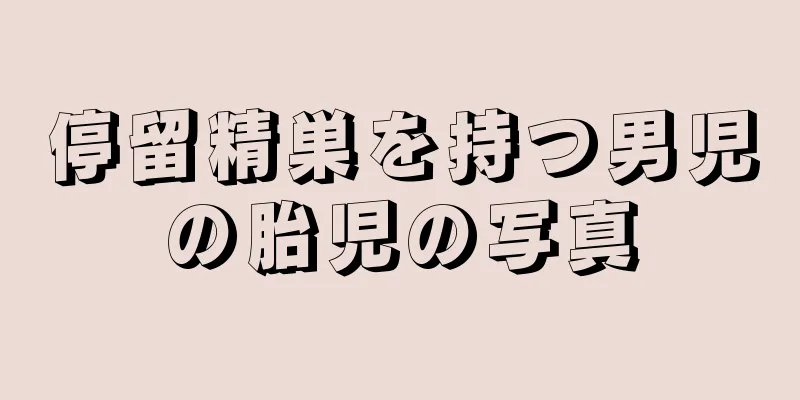 停留精巣を持つ男児の胎児の写真