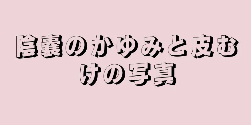 陰嚢のかゆみと皮むけの写真