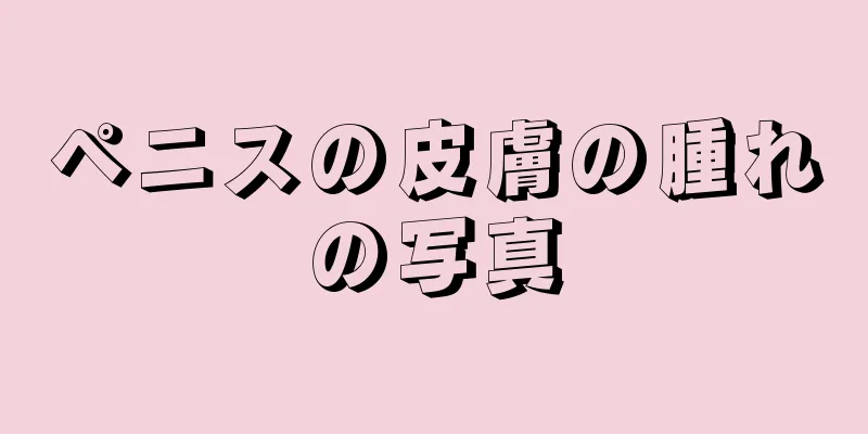 ペニスの皮膚の腫れの写真