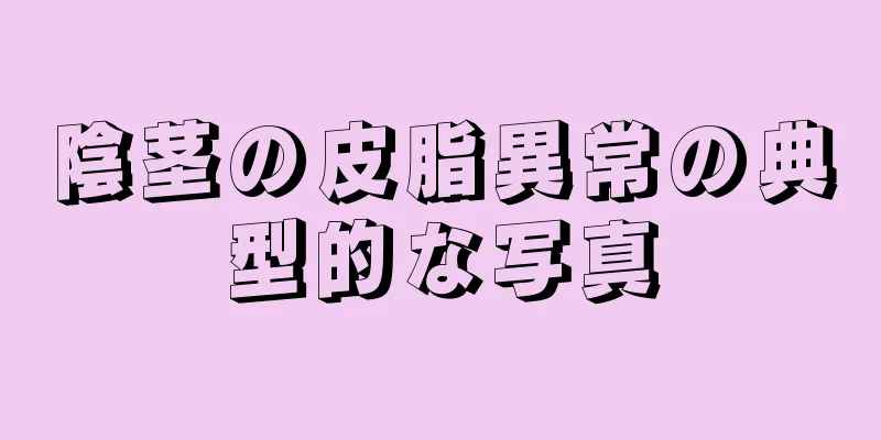 陰茎の皮脂異常の典型的な写真
