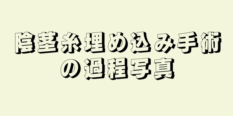 陰茎糸埋め込み手術の過程写真