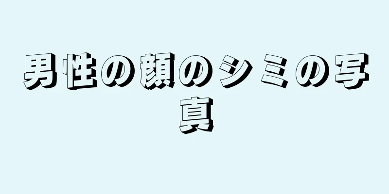 男性の顔のシミの写真