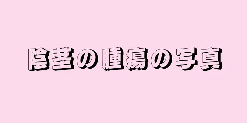 陰茎の腫瘍の写真