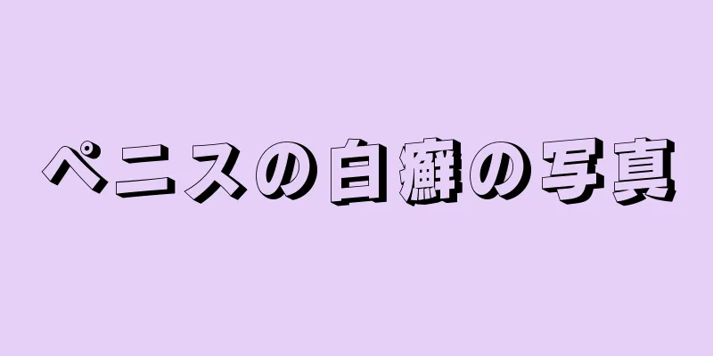 ペニスの白癬の写真