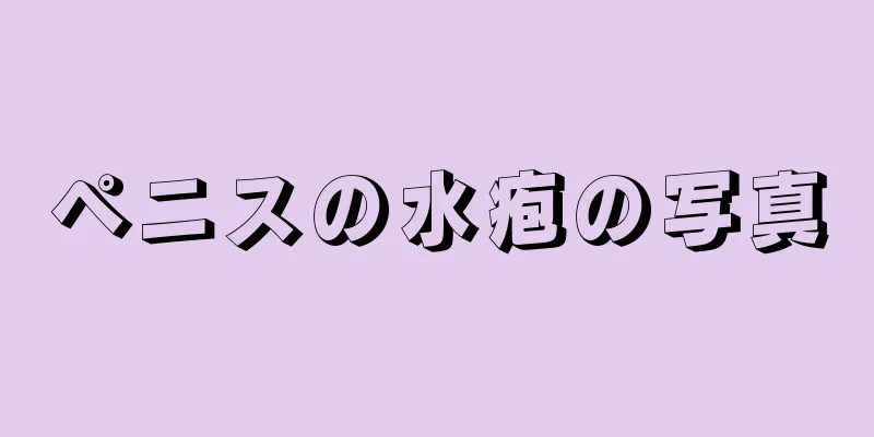 ペニスの水疱の写真