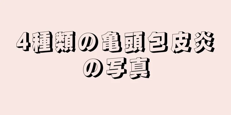 4種類の亀頭包皮炎の写真