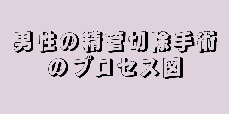 男性の精管切除手術のプロセス図