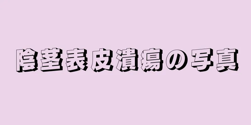 陰茎表皮潰瘍の写真